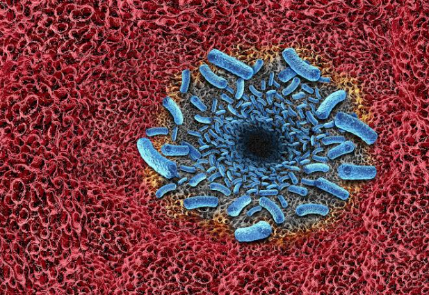 Vibrio Vulnificus