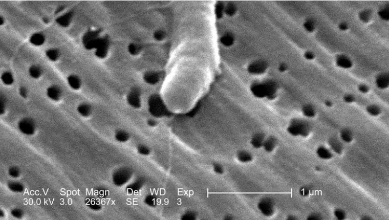 flesh-eating bacteria